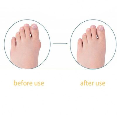 TPR Adulto Big Foot Straightener Bunion Correção Dia/Noite Crianças Dedo Polegar Straightener Para Sapatos